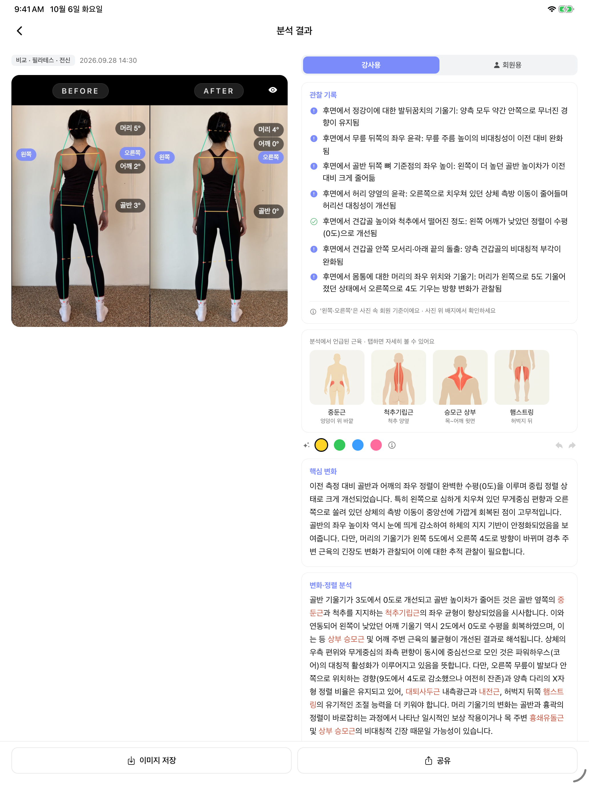 워니노트 iPad AI 자세 분석 비포·애프터 결과